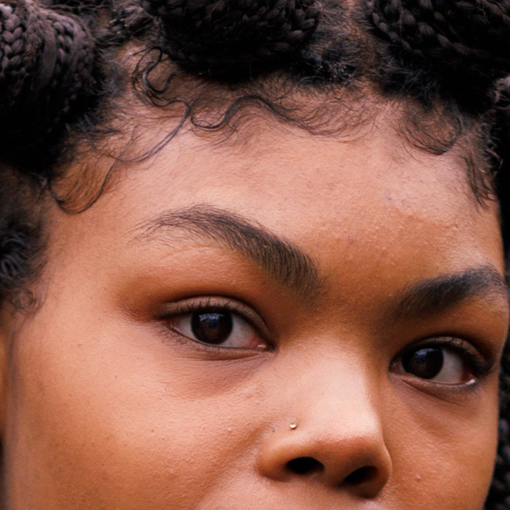 Dark Under Eye Circles in Black, Brown and Asian Skin:
